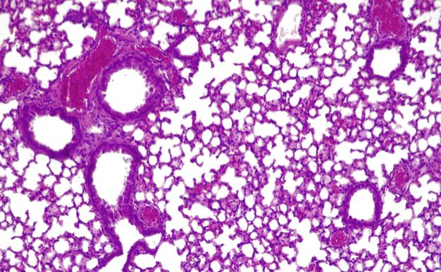 Tejido pulmonar de ratón donde se ha aplicado la 'píldora viva'. La Fundación 'la Caixa' apoya la labor de las entidades sociales de La Rioja y de sus voluntarios/ L.C.